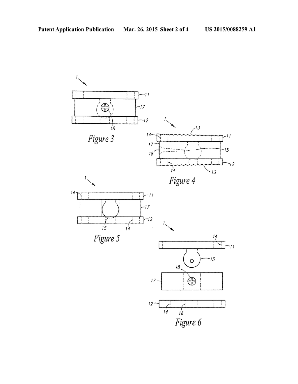 SPINAL IMPLANT - diagram, schematic, and image 03