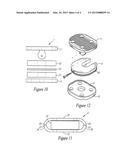 SPINAL IMPLANT diagram and image