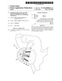 METHOD OF IMPLANTING A REVERSE SHOULDER ORTHOPAEDIC IMPLANT HAVING AN     ELLIPTICAL GLENOSPHERE COMPONENT diagram and image