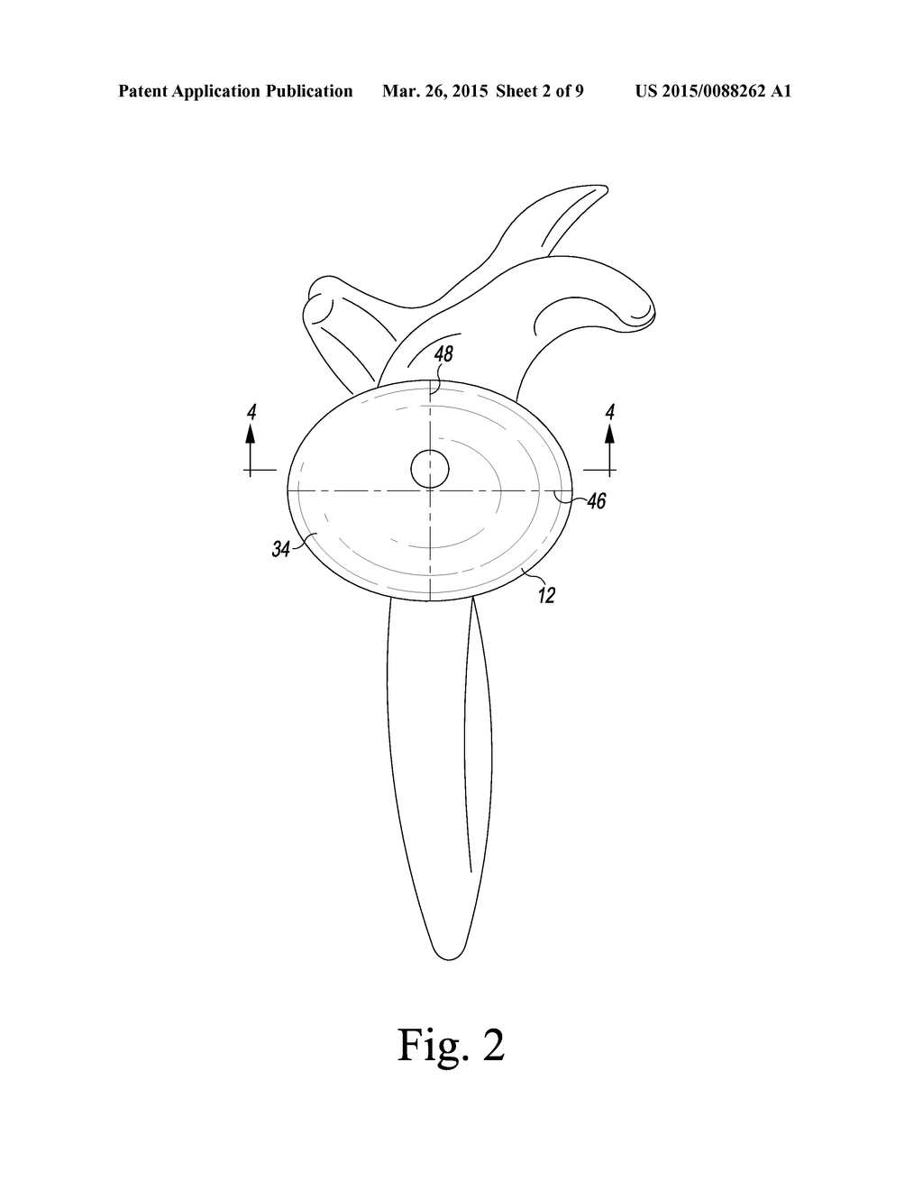 METHOD OF IMPLANTING A REVERSE SHOULDER ORTHOPAEDIC IMPLANT HAVING AN     ELLIPTICAL GLENOSPHERE COMPONENT - diagram, schematic, and image 03