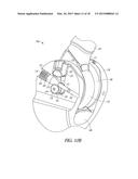 ELBOW PROSTHESIS diagram and image