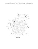 ELBOW PROSTHESIS diagram and image