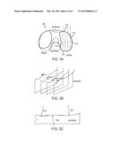 Implant for Restoring Normal Range Flexion and Kinematics of the Knee diagram and image