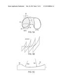 Implant for Restoring Normal Range Flexion and Kinematics of the Knee diagram and image