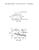 Implant for Restoring Normal Range Flexion and Kinematics of the Knee diagram and image