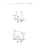 Implant for Restoring Normal Range Flexion and Kinematics of the Knee diagram and image