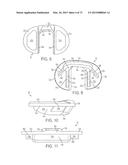 CRUCIATE-RETAINING KNEE PROSTHESIS diagram and image