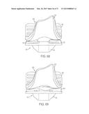 CRUCIATE-RETAINING KNEE PROSTHESIS diagram and image