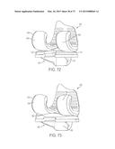 CRUCIATE-RETAINING KNEE PROSTHESIS diagram and image