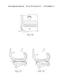 CRUCIATE-RETAINING KNEE PROSTHESIS diagram and image