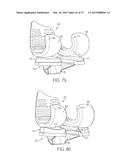 CRUCIATE-RETAINING KNEE PROSTHESIS diagram and image