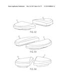 CRUCIATE-RETAINING KNEE PROSTHESIS diagram and image