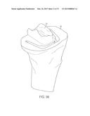 CRUCIATE-RETAINING KNEE PROSTHESIS diagram and image