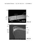 SHAPED ABRASIVE PARTICLES AND METHODS OF FORMING SAME diagram and image