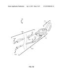 DETANGLING LEAD ASSEMBLY diagram and image