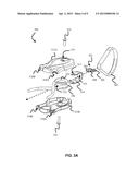 DETANGLING LEAD ASSEMBLY diagram and image