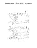 WRAPPABLE STERILE RADIATION SHIELD DRAPE, COMBINATION OF A RADIATION     SHIELD AND STERILE DRAPE THEREFOR AND METHOD OF PROVIDING A STERILE DRAPE     ABOUT A RADIATION SHIELD diagram and image