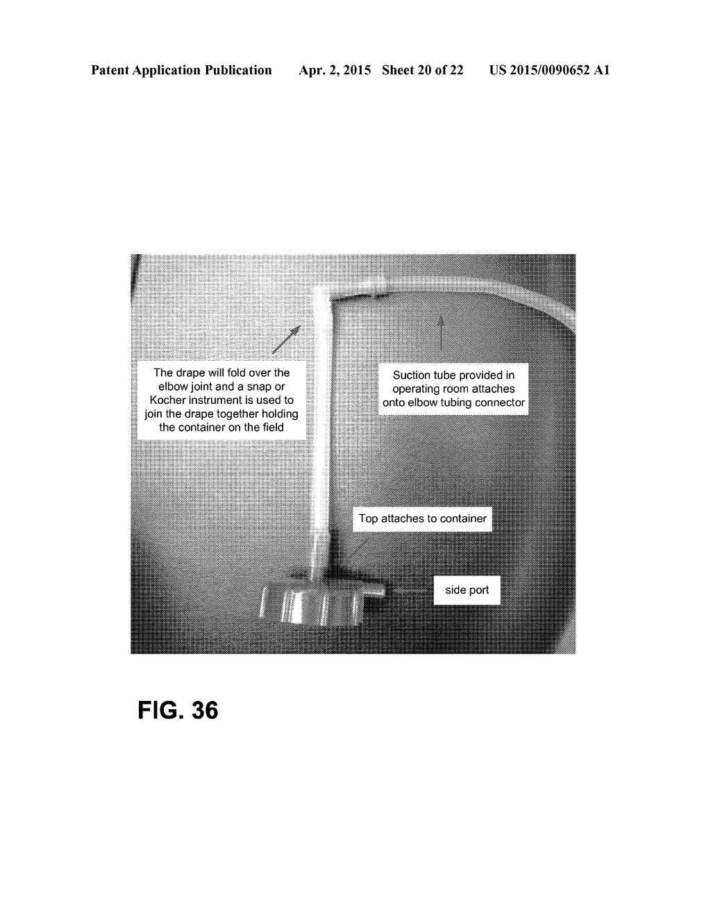 COLLECTION AND FILTRATION VIA SUCTION OF BIOLOGICAL MATERIAL DURING     SURGICAL PROCEDURE - diagram, schematic, and image 21