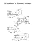 SURGICAL INSTRUMENT WITH WIRELESS COMMUNICATION BETWEEN CONTROL UNIT AND     REMOTE SENSOR diagram and image