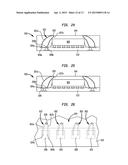 PACKAGE-ON-PACKAGE ASSEMBLY WITH WIRE BONDS TO ENCAPSULATION SURFACE diagram and image