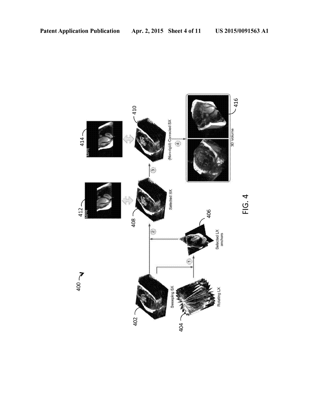 MRI 3D CINE IMAGING BASED ON INTERSECTING SOURCE AND ANCHOR SLICE DATA - diagram, schematic, and image 05