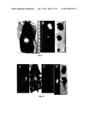 PHOSPHOLIPID ANALOGS AS DIAPEUTIC AGENTS AND METHODS THEREOF diagram and image