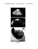 PHOSPHOLIPID ANALOGS AS DIAPEUTIC AGENTS AND METHODS THEREOF diagram and image