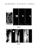 PHOSPHOLIPID ANALOGS AS DIAPEUTIC AGENTS AND METHODS THEREOF diagram and image