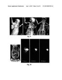 PHOSPHOLIPID ANALOGS AS DIAPEUTIC AGENTS AND METHODS THEREOF diagram and image