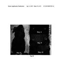 PHOSPHOLIPID ANALOGS AS DIAPEUTIC AGENTS AND METHODS THEREOF diagram and image