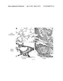 TREATMENT OF PULMONARY VASCULAR REMODELING WITH NEPRILYSIN diagram and image