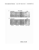 TREATMENT OF PULMONARY VASCULAR REMODELING WITH NEPRILYSIN diagram and image