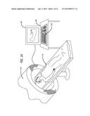 DEVICES AND METHODS FOR ENHANCING BONE GROWTH diagram and image