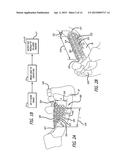 DEVICES AND METHODS FOR ENHANCING BONE GROWTH diagram and image