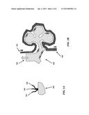 BIOARTIFICIAL FILTRATION ORGAN diagram and image