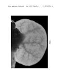 BIOARTIFICIAL FILTRATION ORGAN diagram and image