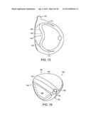 GOLF CLUB HEAD WITH STIFFENING MEMBER diagram and image