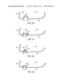 GOLF CLUB HEAD WITH STIFFENING MEMBER diagram and image