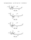 GOLF CLUB HEAD WITH STIFFENING MEMBER diagram and image