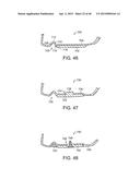 GOLF CLUB HEAD WITH STIFFENING MEMBER diagram and image