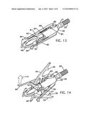 Broadhead Arrowhead With Two-Stage Expansion diagram and image