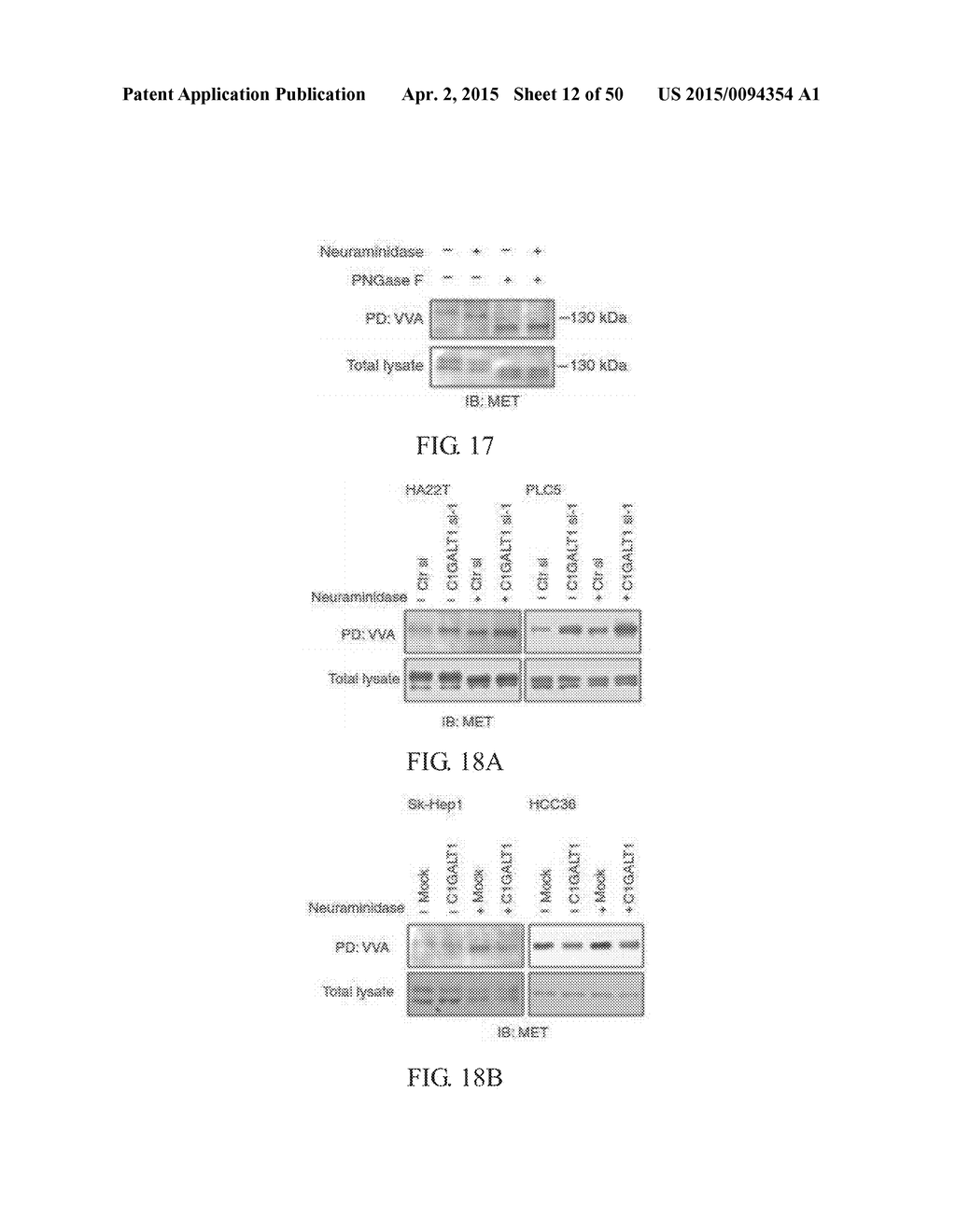 METHOD FOR TREATING CELL PROLIFERATIVE DISORDER BY INHIBITING C1GALT1     EXPRESSION - diagram, schematic, and image 13