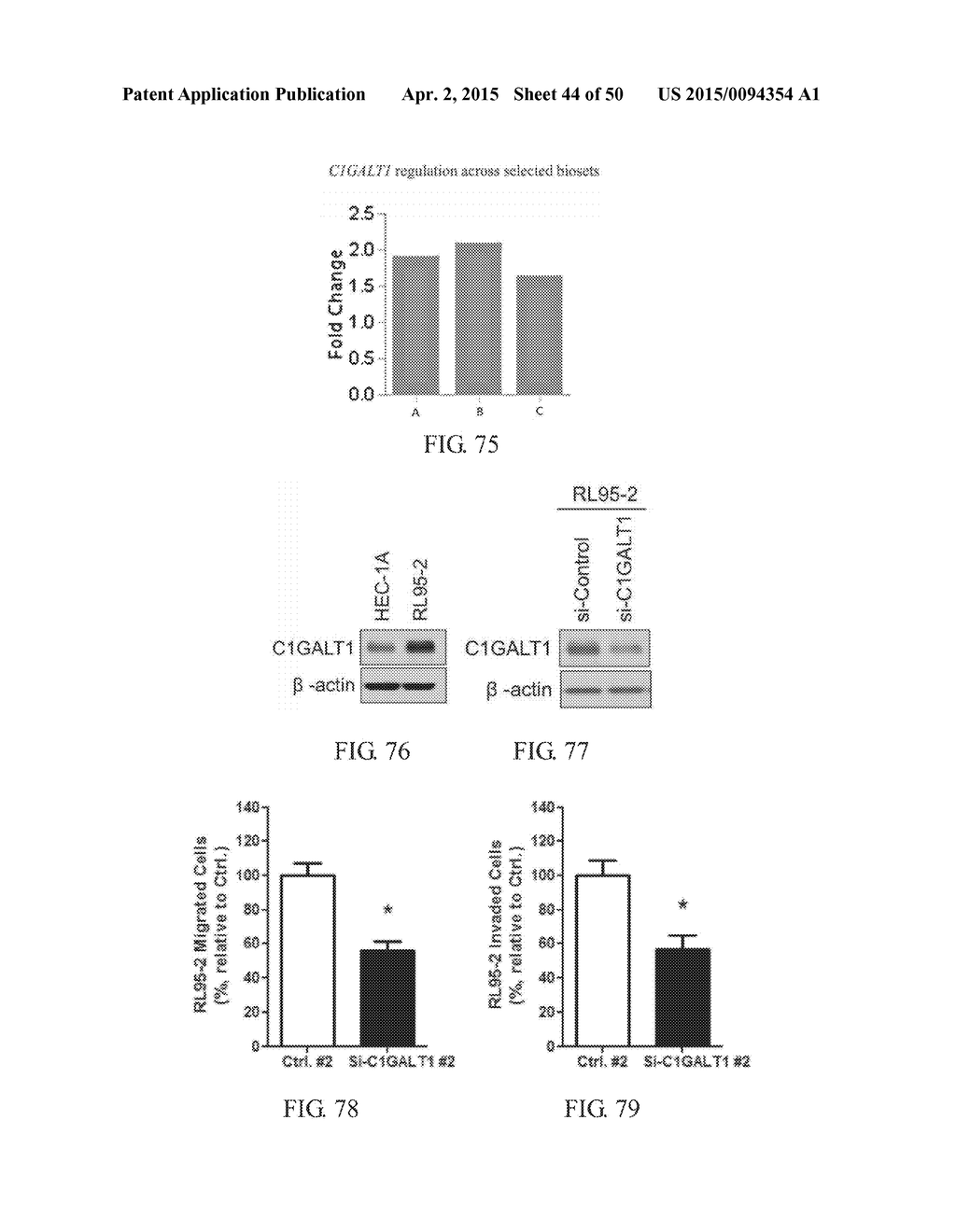 METHOD FOR TREATING CELL PROLIFERATIVE DISORDER BY INHIBITING C1GALT1     EXPRESSION - diagram, schematic, and image 45