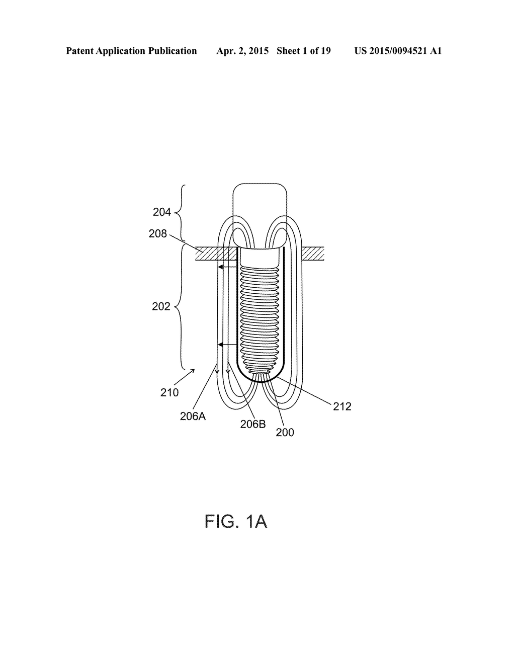 BONE ENHANCEMENT DEVICE AND METHOD - diagram, schematic, and image 02