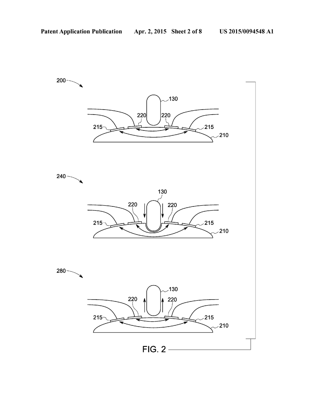 SYSTEM AND METHOD FOR DETERMINING A HYDRATION LEVEL OF A TISSUE REGION - diagram, schematic, and image 03