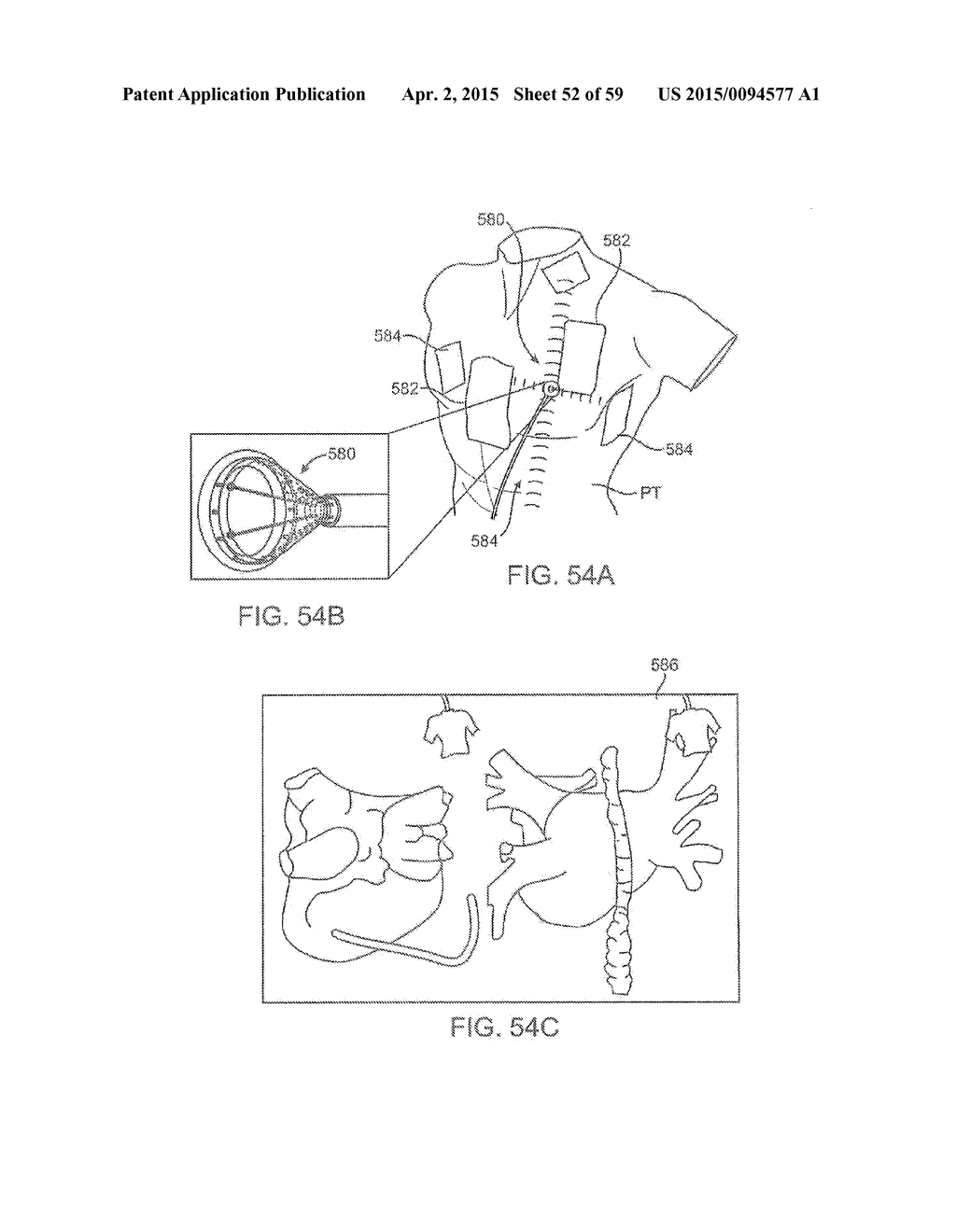 Electrophysiology Mapping And Visualization System - diagram, schematic, and image 53