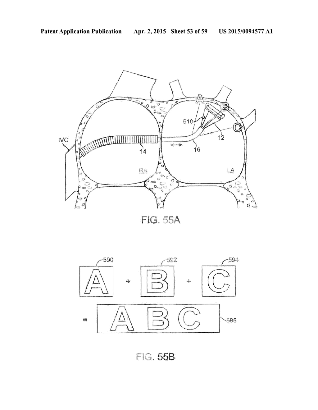 Electrophysiology Mapping And Visualization System - diagram, schematic, and image 54