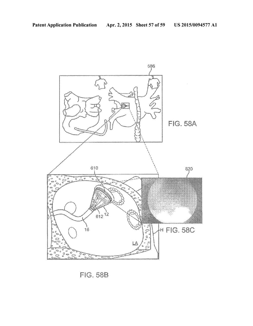 Electrophysiology Mapping And Visualization System - diagram, schematic, and image 58