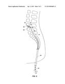 CATHETERS INCLUDING BEND INDICATORS, CATHETER ASSEMBLIES INCLUDING SUCH     CATHETERS AND RELATED METHODS diagram and image