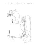 GRAPHICAL USER INTERFACE FOR ASSOCIATION WITH AN ELECTRODE STRUCTURE     DEPLOYED IN CONTACT WITH A TISSUE REGION diagram and image